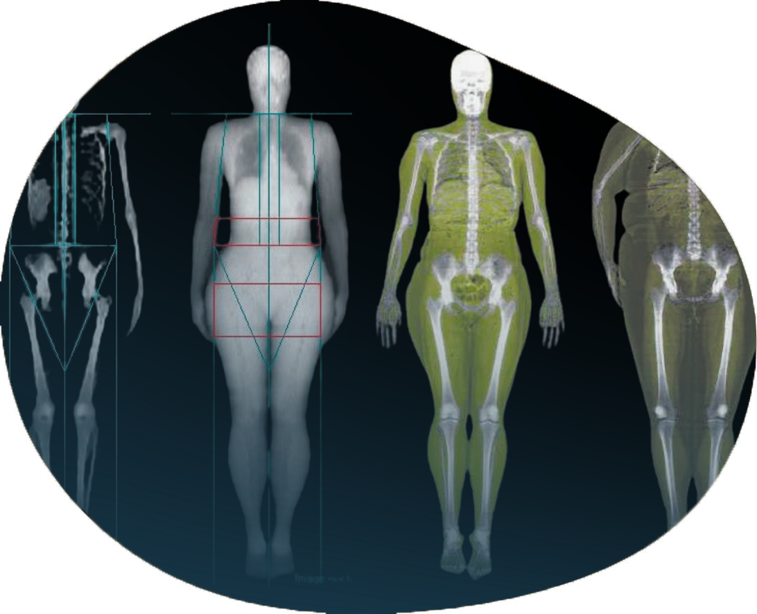 Digital X-Rays